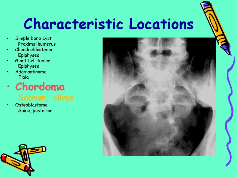 Simple bone cyst Proximal humerus Chondroblastoma Epiphyses Giant Cell tumor Epiphyses Adamantinoma Tibia Chordoma